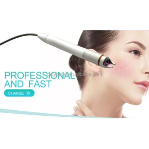 Portable 30mhz Laser Spider Vein Removal Machine , 110v 980nm Diode Laser