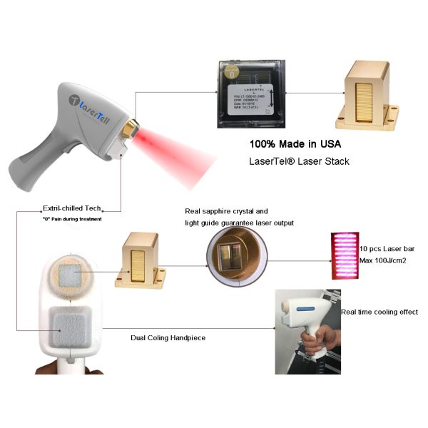Fda Approved 808nm Diode Laser Hair Removal Beauty Machine