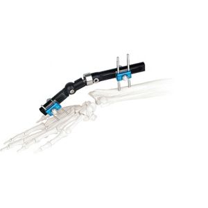 Orthopedic Surgical External Fixation Device Wrist