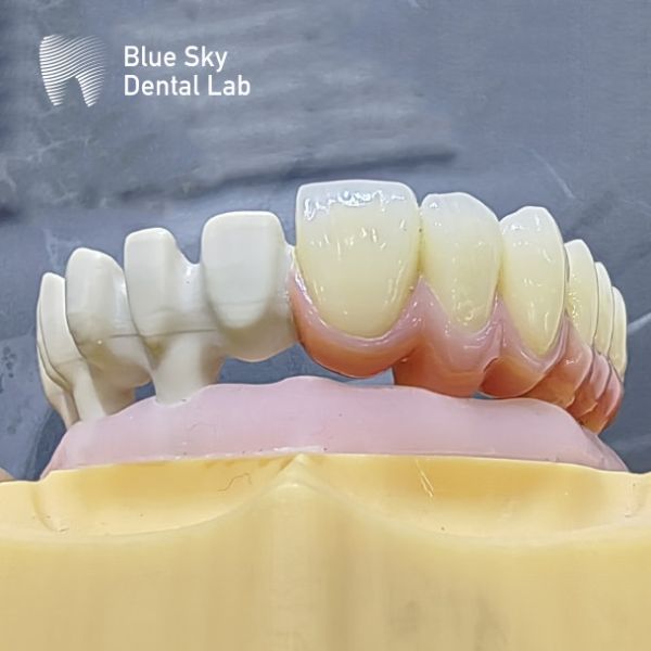 Customize Color Implant Cases with Smooth Surface Nature Design for Universal