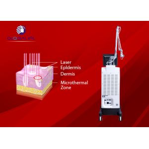 Globalipl New Portable CO2 Fractional Laser Machine For Acne Removal And Skin