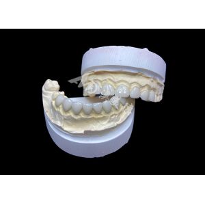 Customization Ultra Thin Glass Ceramic Veneers High Translucency for a Natural