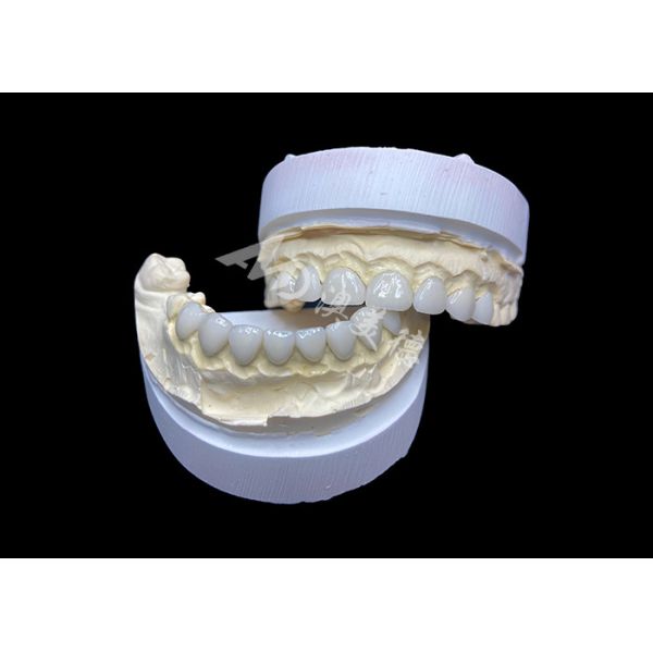 Customization Ultra Thin Glass Ceramic Veneers High Translucency for a Natural