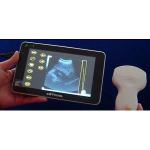 Cheap USB Ultrasound Probe Digital Portable Ultrasound Scanner With Probe of Frequency 2~15MHz for sale