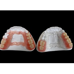 Partial Removable Denture , removable dental prosthesis For Chewing And Speaking