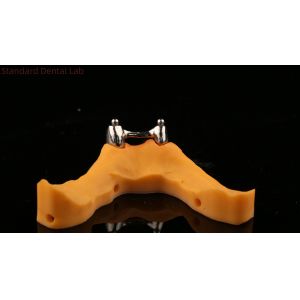 Ivoclar Digital Dental Implant Bar Denture with Attachments , Full Acrylic