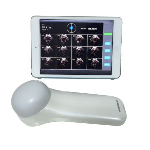 China Portable 4D Wireless Bladder Scanner WIFI Ultrasound Probe for Evaluation of Residual Quality After Urination on sale