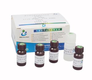 China Sperm DNA Fragmentation Test Kit AOT Flow Cell Methodology on sale China Sperm DNA Fragmentation Test Kit AOT Flow Cell Methodology on sale
