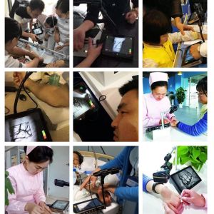 Medical Portable Vein Locator Device Spider Vein Removal Machine Imaging Depth <