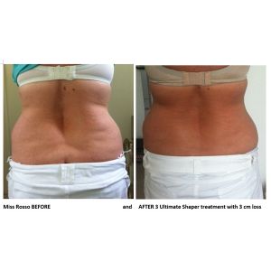 Cheap Promotion!!! Salon and spa use effective hifu body slimming machine for sale