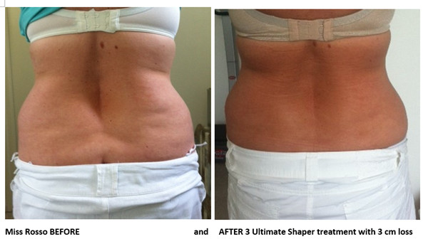 Promotion!!! Salon and spa use effective hifu body slimming machine