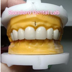 Ivoclar Zirconia Crown Veneers High Translucency Esthetic