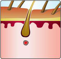 beauty spa equipment good result portable 12 month warranty IPL machine