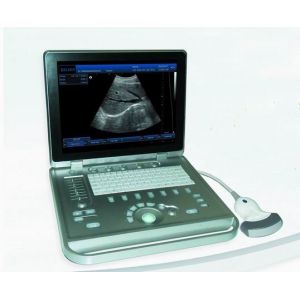 3D Digital Laptop Portable Ultrasound Scanner With All Kinds of Probe