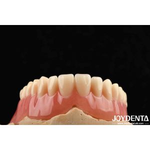 China Good Elasticity Acrylic Denture Finish For Lightweight Personalized Customization And Customized Design on sale