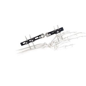 Orthopedic Surgical External Fixation Device Wrist