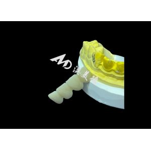 Customized Smooth Surface Zirconia Dental Crown High Biocompatibility Stain