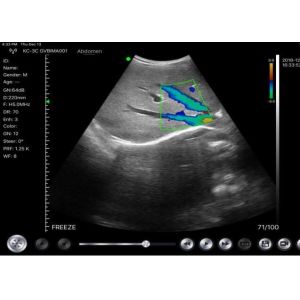 Home Doppler Ultrasound Portable Diagnostic Hand held Doppler Ultrasound