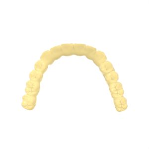 Robust Temporary Crown And Bridge Resin For Long Term Temporary Restorations