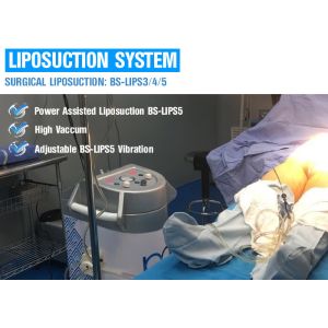 Ultrasonic Power Assisted Liposuction Equipment Adjustable Vacuum Range