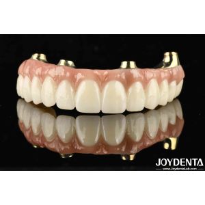 Functionality Ti-Bar Compatible With Natural Teeth And Gums Restores Chewing