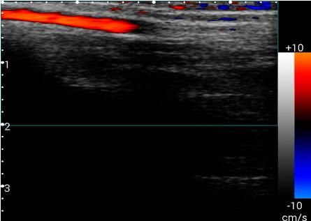 Andriod Color Doppler Ultrasound Scanner , Hand Held Doppler Machine Only 550g Weight