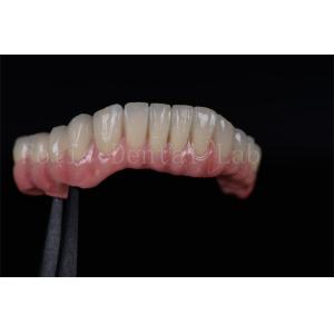 Cheap High Success Rate All On Four All On Six Zirconia Titanium Dental Implants Customized for sale