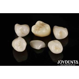 Easy Cementation Emax Inlay Onlay Medium Strength Natural-looking Esthetics