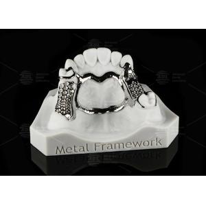 Repairable Cobalt Chromium Dental Metal Framework Partial Denture