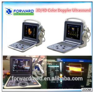 China Hot Sale Portable Ultrasound Machine Color Doppler on sale