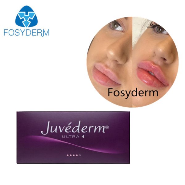 Juvederm Ultra 3 Medical Hyaluronic Acid Dermal Filler