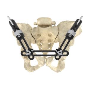 Cheap Intra Articular Monolateral External Fixator Precise Single Arm External Fixator for sale