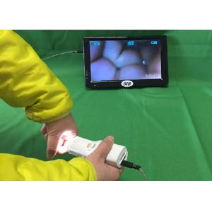 Cheap Portable Digital Electronic Colposcope for sale