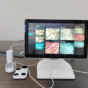 Desktop Hair Scalp Detector Professional With Dual System And Smart Switching