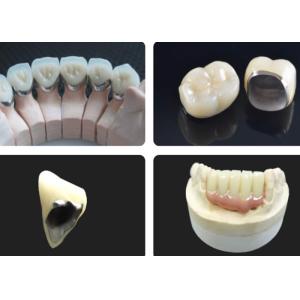 Moderate Translucency Porcelain Fused To Metal PFM Crown , PFM Ceramic Crown