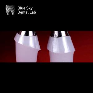 Customized Zirconia Abutment With Titanium Base Blue Sky Implant