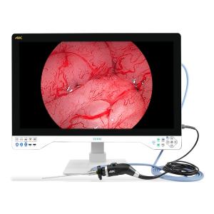 China Revolutionize Your Medical Practice with 4K 32 Inches Endoscope Camera System for Enhanced Imaging on sale