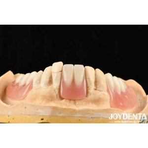 Diverse And Lightweight Resin Material Acrylic Denture Finish