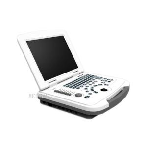 80 elements Ultrasound Scanner Laptop Ultrasound Scanner B580 with Battery