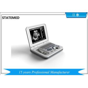 Diagnostic Laptop Ultrasound Machine Dynamic Electron Focusing For Human Body