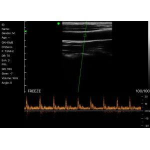 Wifi Color Doppler Handheld Ultrasound Scanner Linear And Convex Connected To