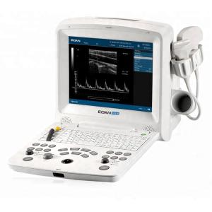 DUS 60 new compact ultrasound system